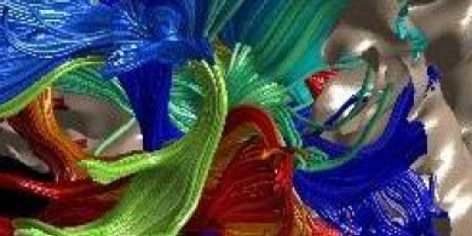 Human body part with colors to note different structures